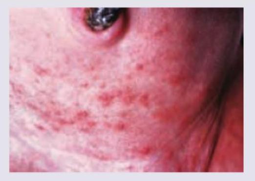 Image for question 69