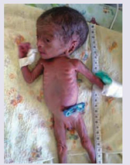 Image for question 738