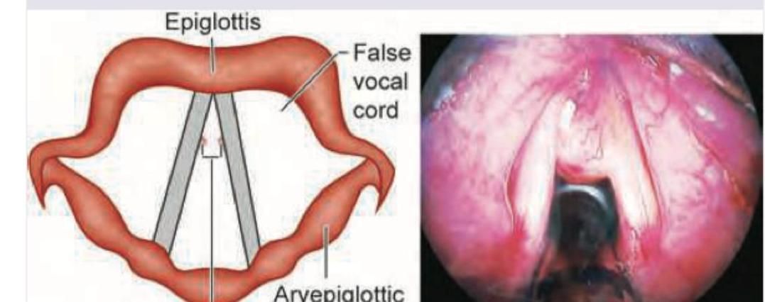 Image for question 37