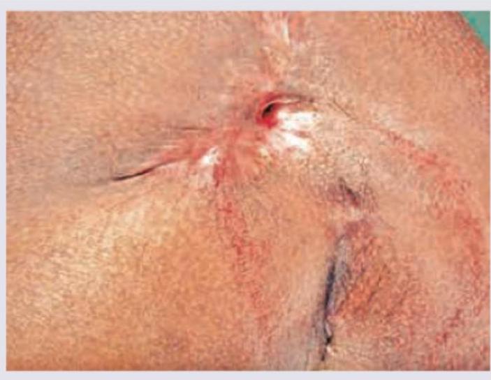 Image for question 101