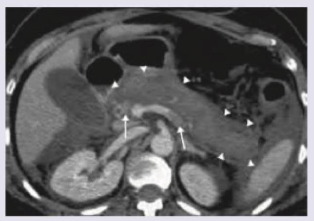 Image for question 541