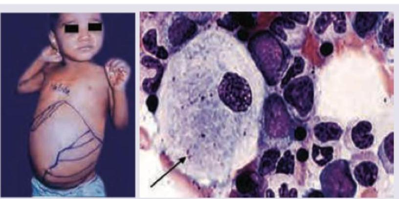 Image for question 166