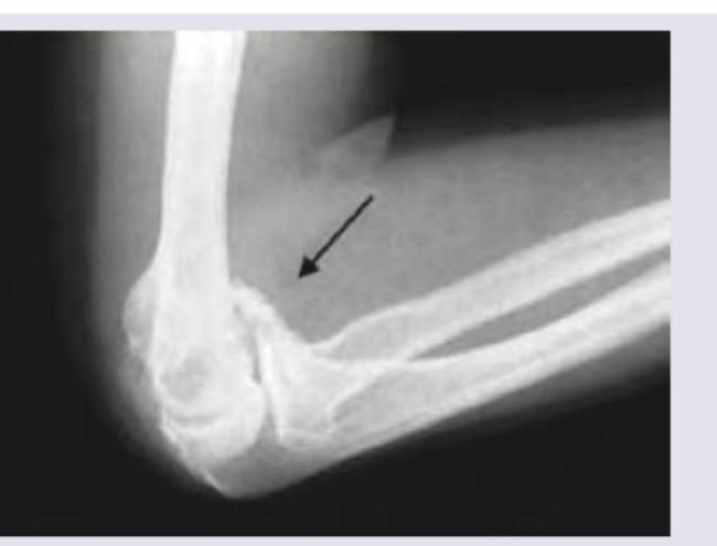 Image for question 913