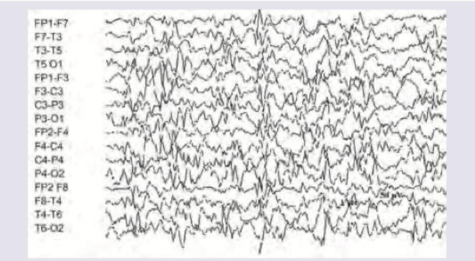 Image for question 206