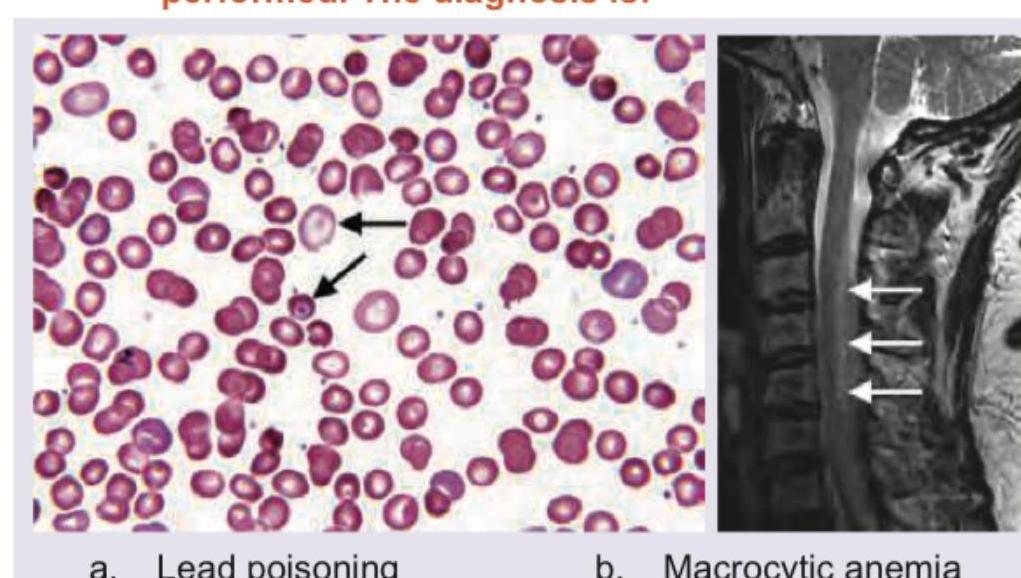 Image for question 861