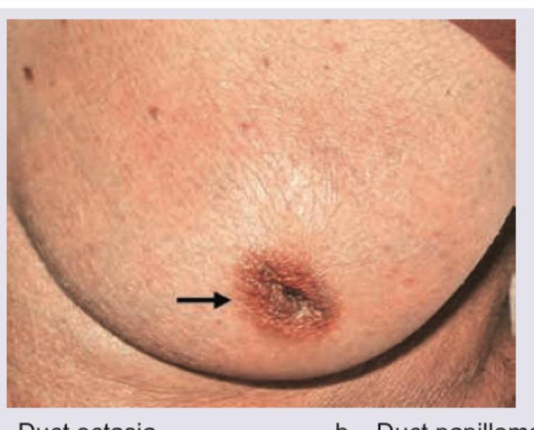 Image for question 274