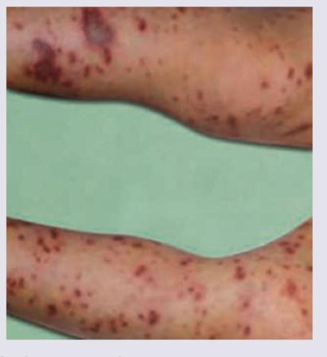 Image for question 56