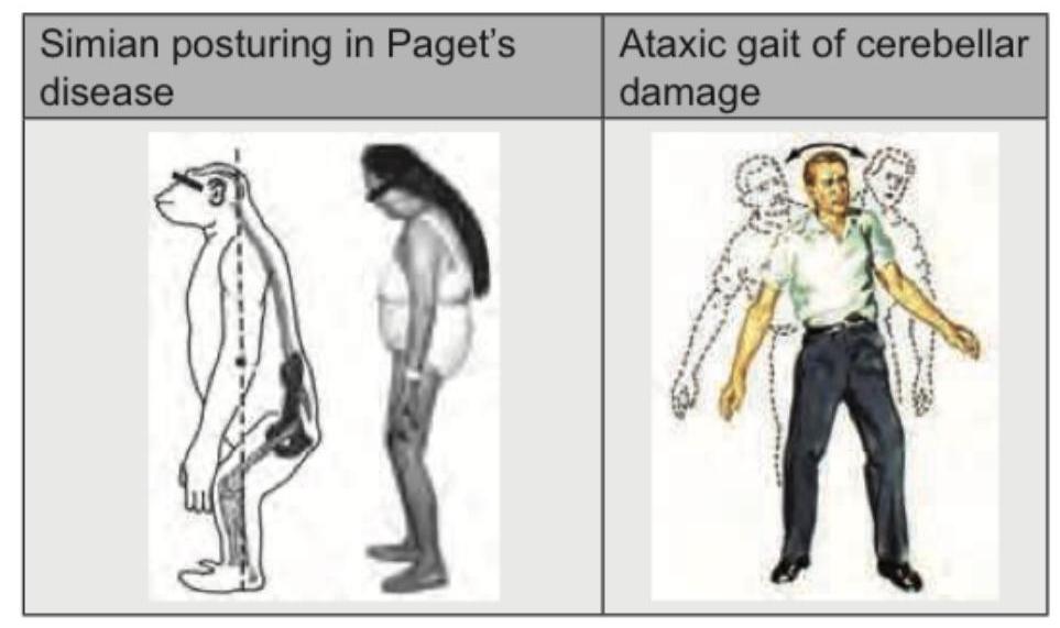 Image for question 121