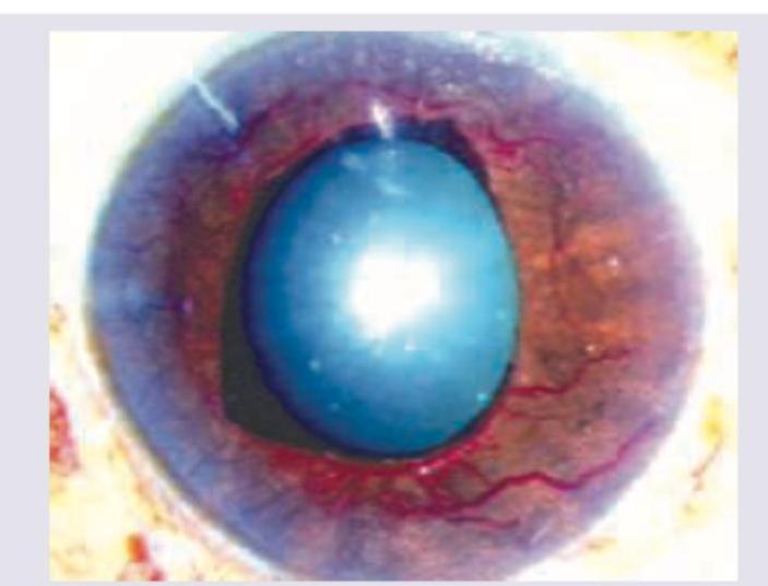 Image for question 463