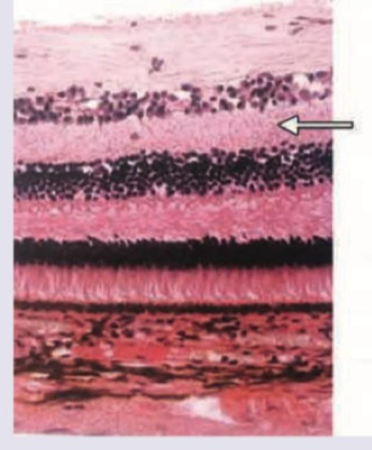 Image for question 42