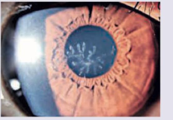 Image for question 322