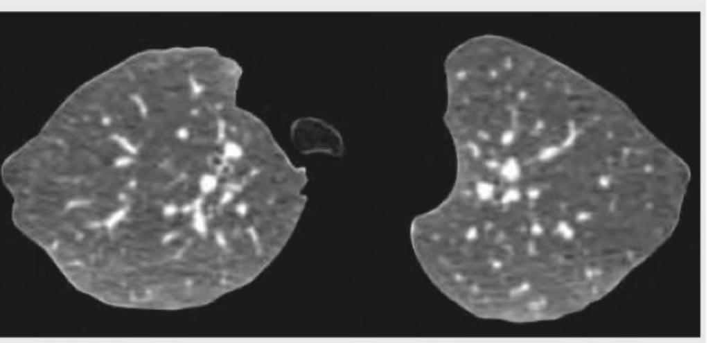 Image for question 392