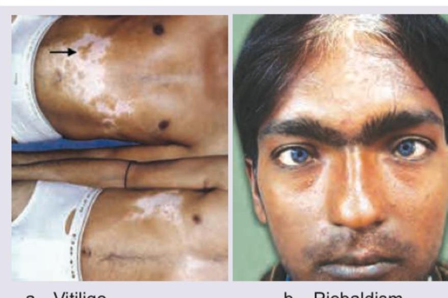 Image for question 85