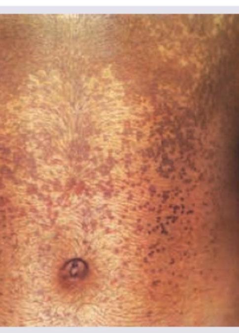 Image for question 120