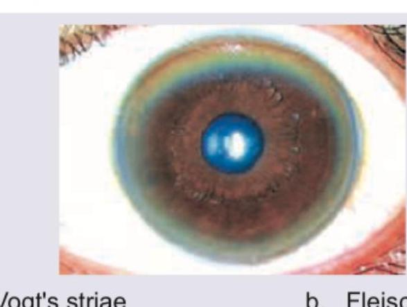 Image for question 402