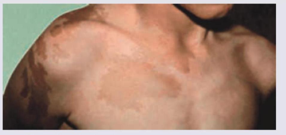 Image for question 256