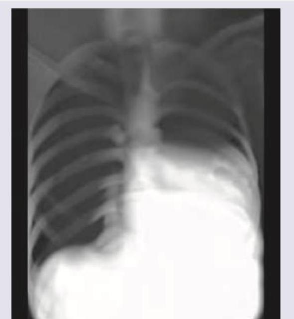 Image for question 376