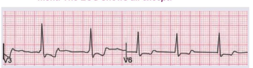 Image for question 294