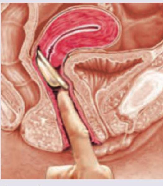 Image for question 549