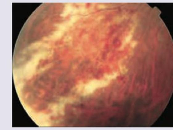 Image for question 448