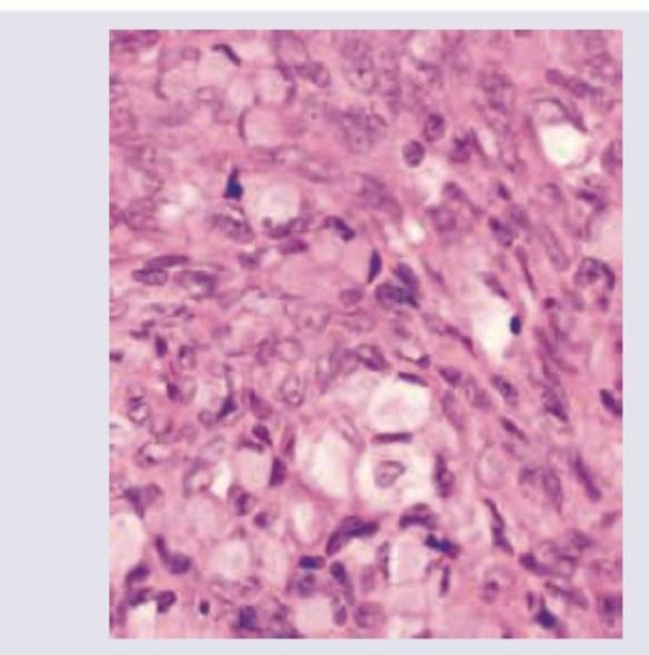 Image for question 236