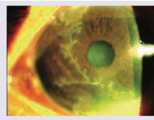 Image for question 317