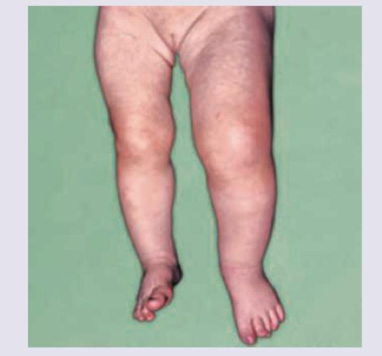 Image for question 650