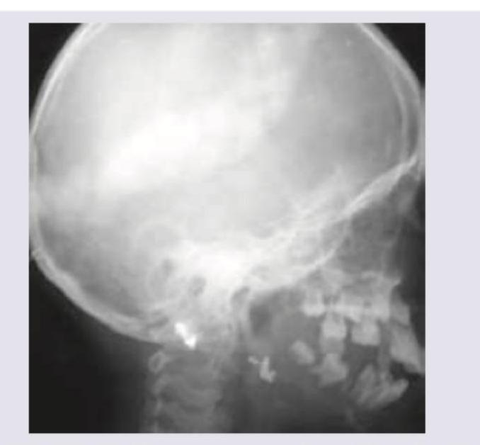 Image for question 72