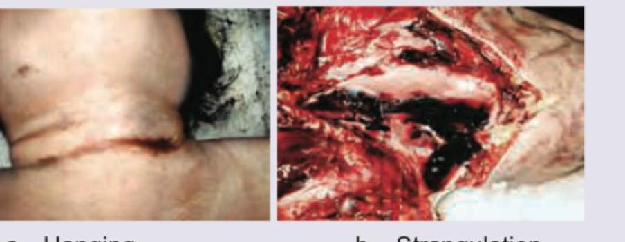 Image for question 231