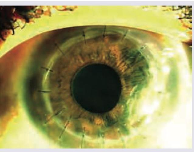 Image for question 314