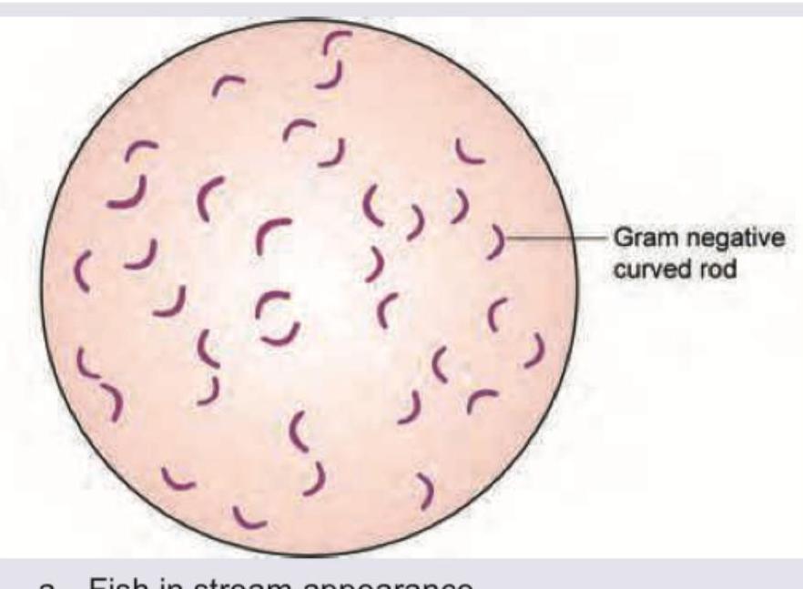 Image for question 125