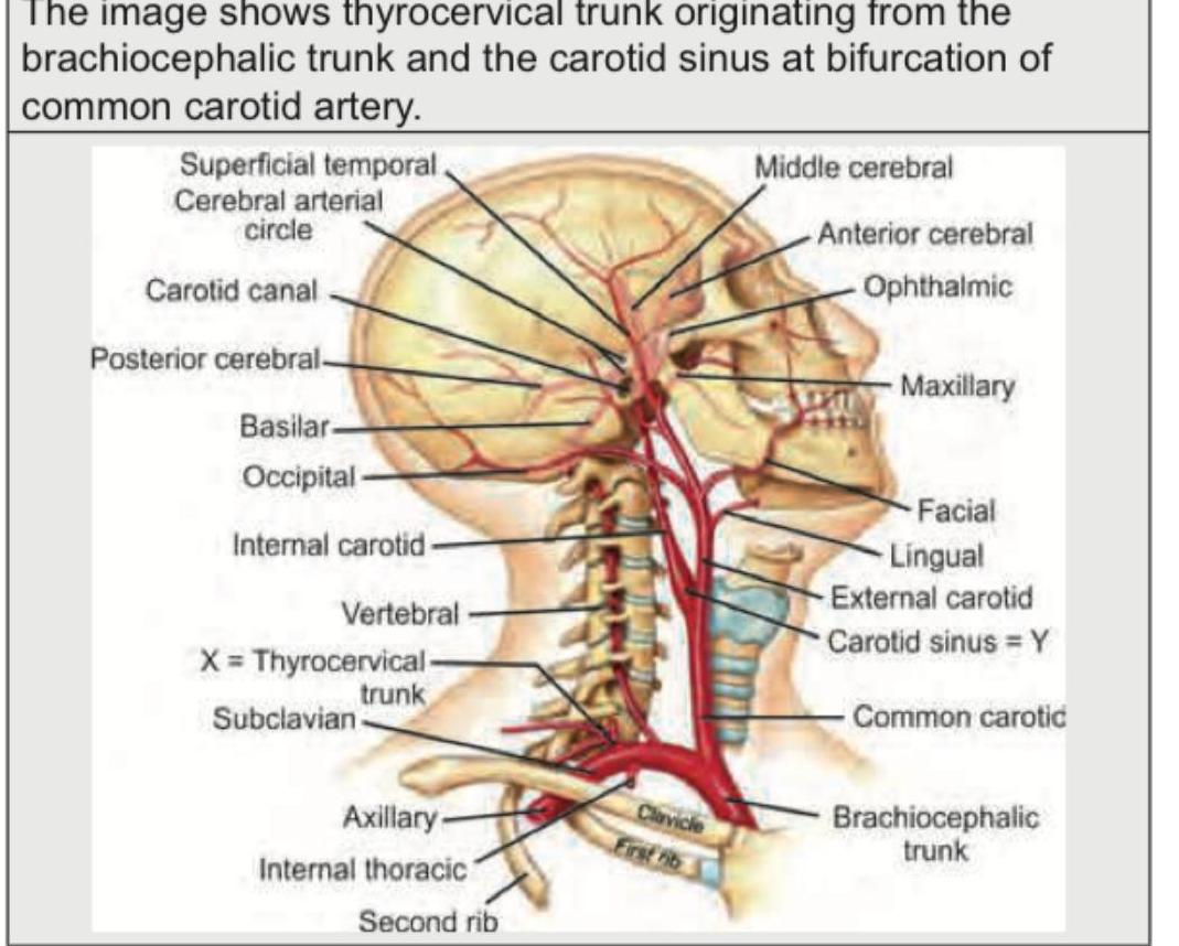 Image for question 344