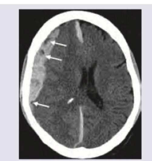 Image for question 749