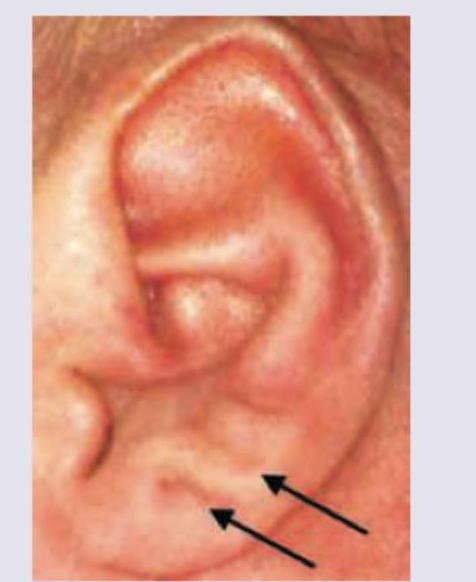 Image for question 658