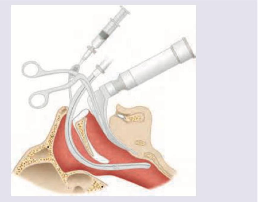 Image for question 306