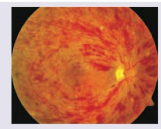 Image for question 453