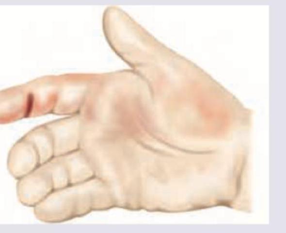 Image for question 191