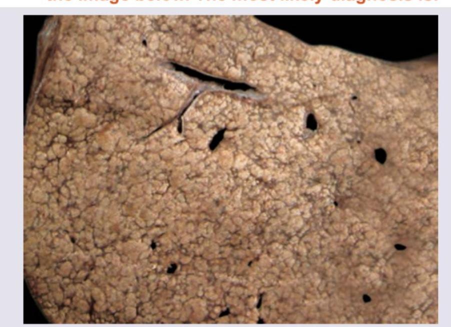 Image for question 353