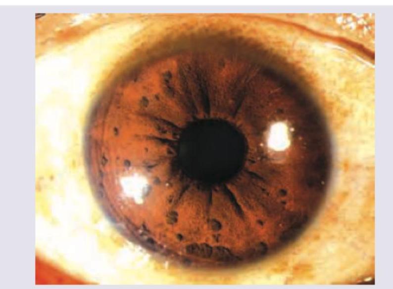 Image for question 359