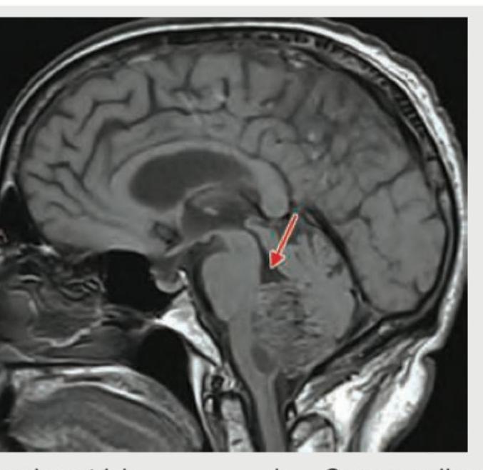 Image for question 71