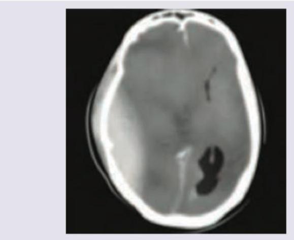 Image for question 750