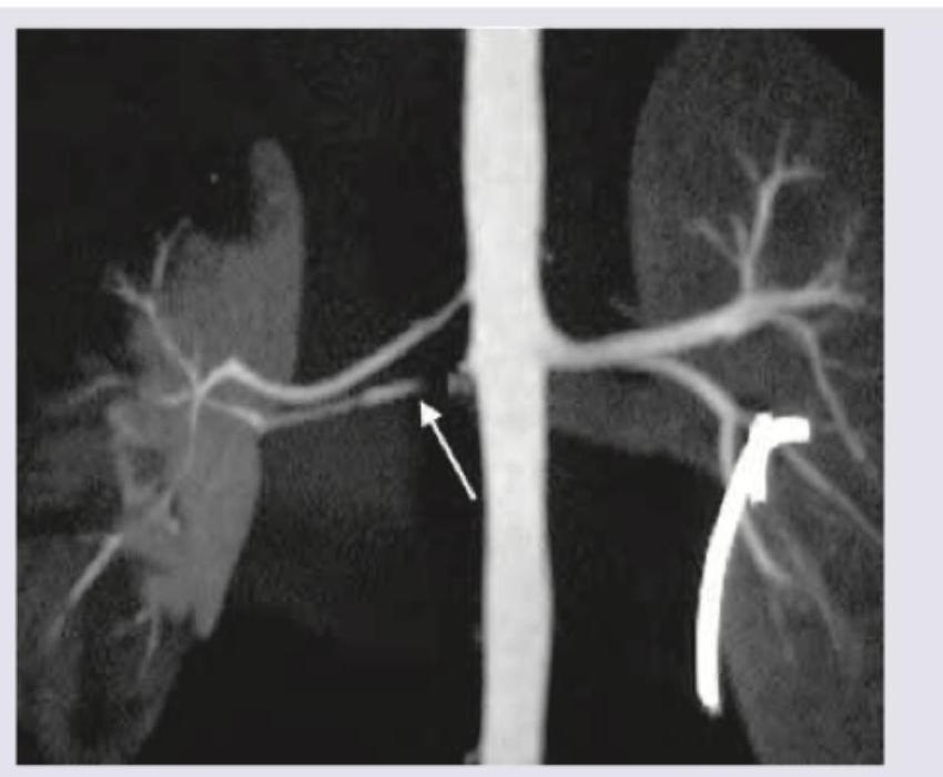 Image for question 92