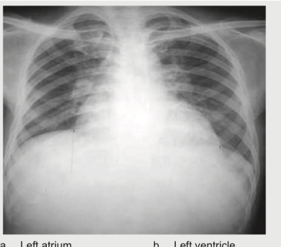 Image for question 107