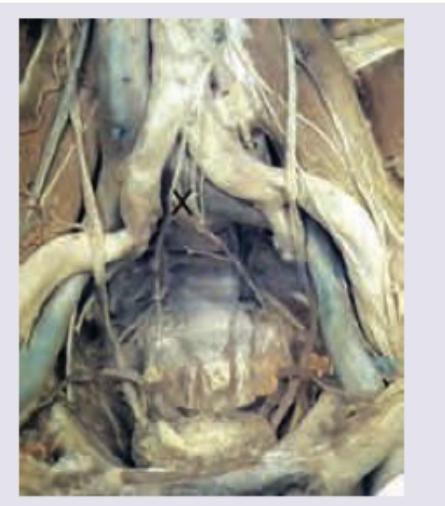 Image for question 702