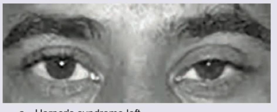 Image for question 247