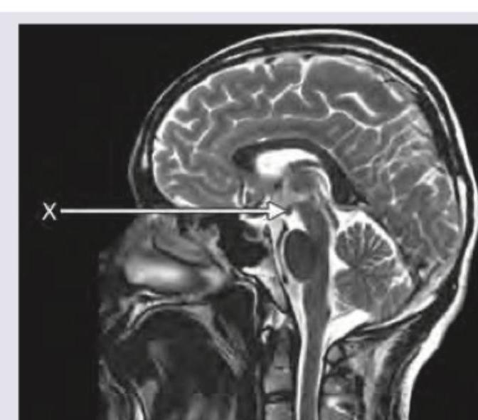 Image for question 9