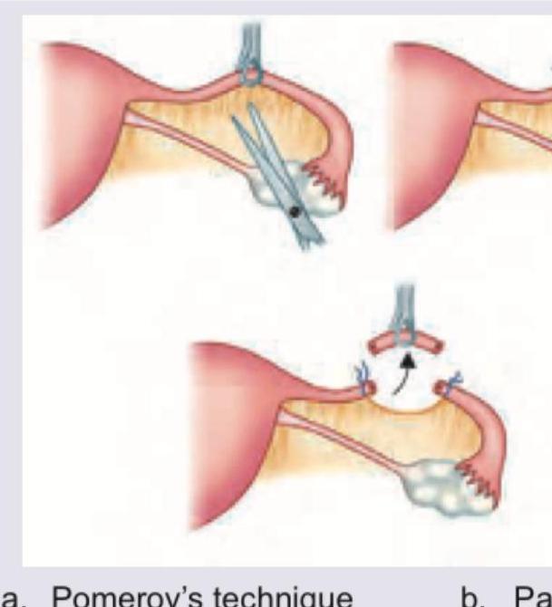 Image for question 546