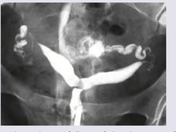 Image for question 340