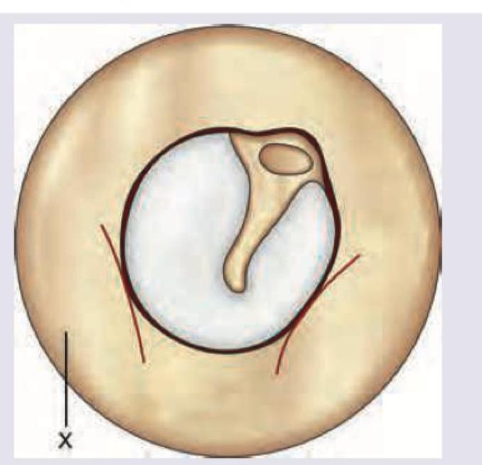 Image for question 1165