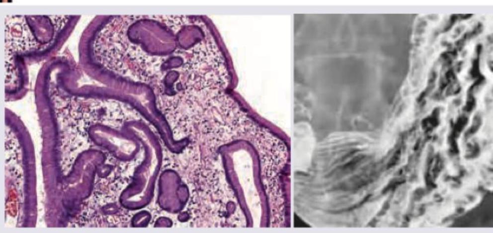 Image for question 460